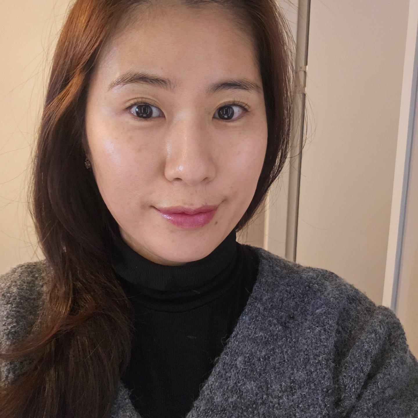 终于对泛红和晒斑动手了——M22 王者之心光子
