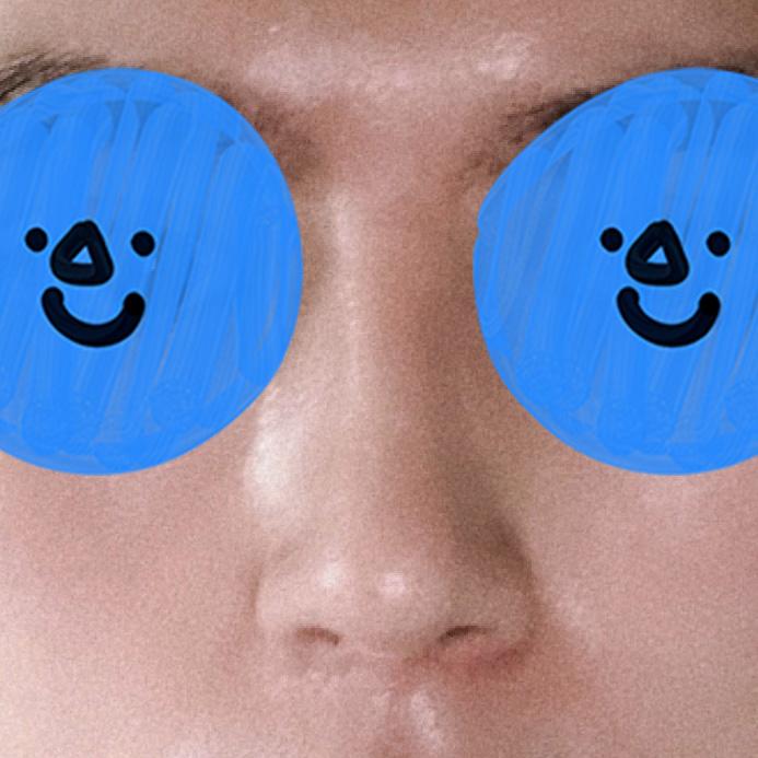 My Rhinoplasty experience at FlowMD ✨