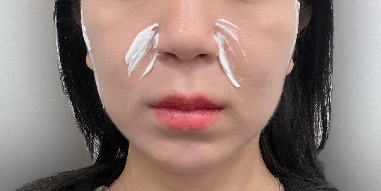 Finally tackled loss of glow and firmness with 5D Collagen Lift